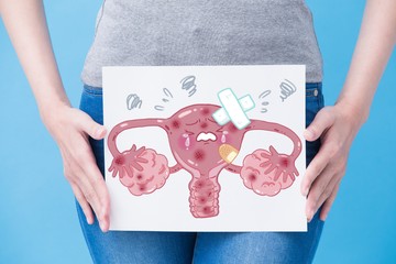 petefészekrák, tünetei, kezelése, tumor, daganat