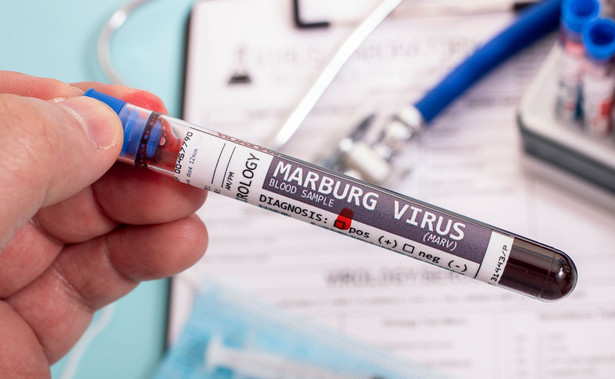 11 ofiar śmiertelnych gorączki krwotocznej spowodowanej przez wirus Marburg