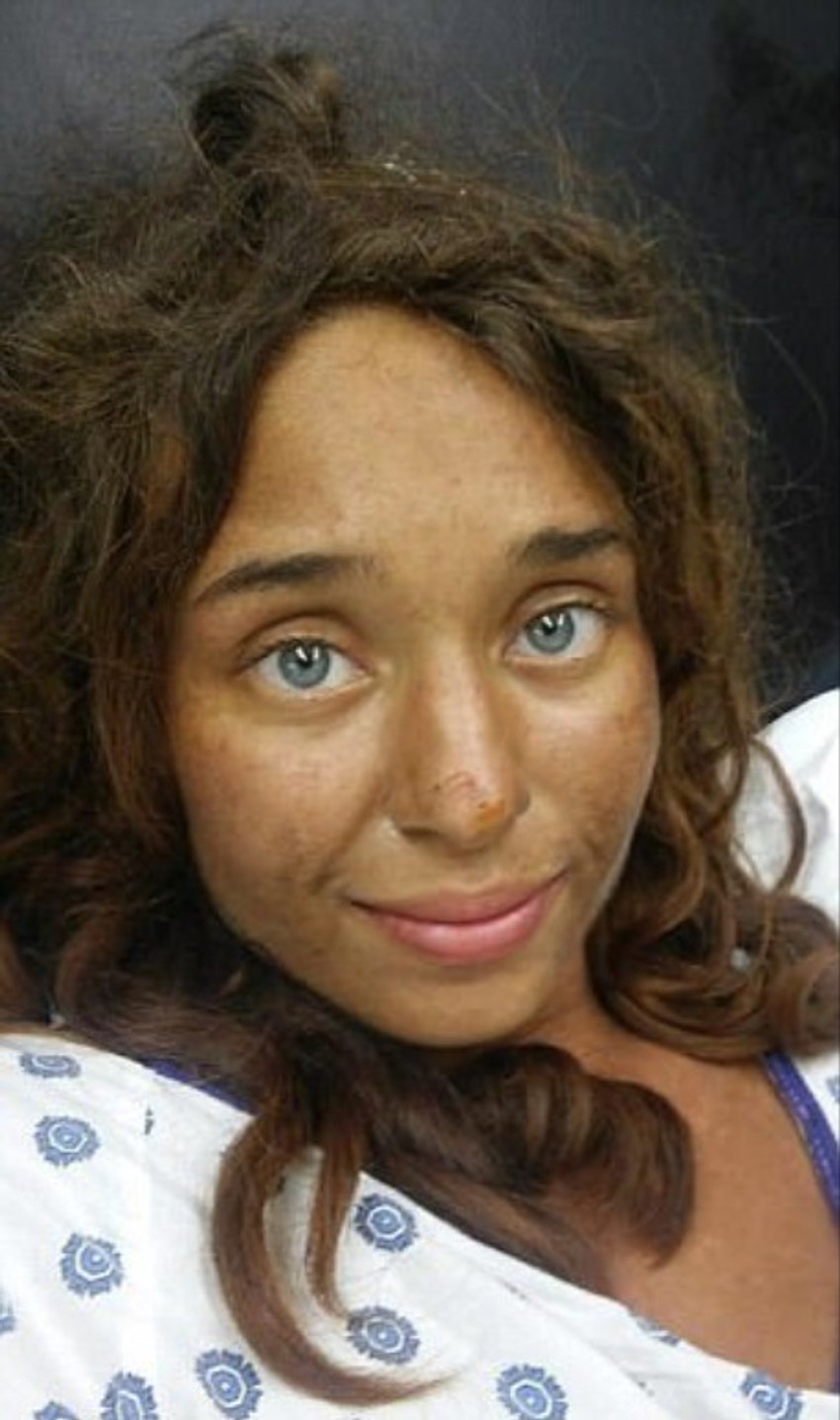 Lisa Teris nakon što se vratila kući