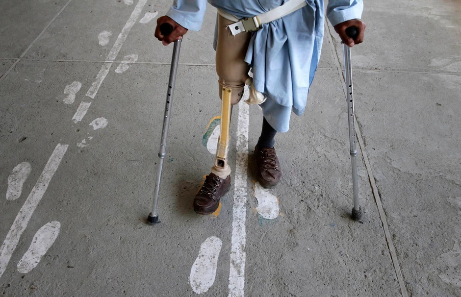 Na hiljade ljudi ostalo je bez udova zbog nagaznih mina