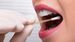 Zapalenia błony śluzowej jamy ustnej - objawy, leczenie, zapobieganie