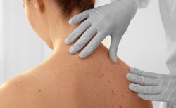 Dermatolodzy: u 20 proc. chorych na Covid-19 pojawiają się zmiany na skórze