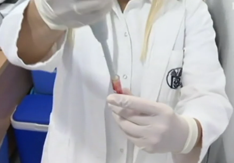 U krv se dodaju i dve kapi razređivača, a kroz 15 minuta test može da se očita