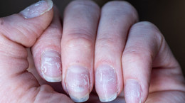 Jak uratować paznokcie po hybrydzie? Domowe sposoby na regenerację i wzmocnienie