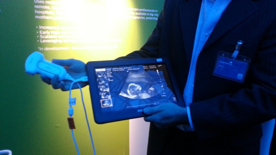 Ultrasonograf złożony z przetwornika i tabletu zapewnia jakość obrazu porównywalną z uzyskiwaną z wykorzystaniem standardowych aparatów USG. Jest on jednak przenośny i łatwy w obsłudze, umożliwia lekarzom wykonywanie precyzyjnej diagnostyki ultrasonograficznej jamy brzusznej oraz badań ginekologicznych i położniczych w dowolnym miejscu, np. w domu ciężarnych pacjentek na wsiach oddalonych od gabinetów lekarskich.