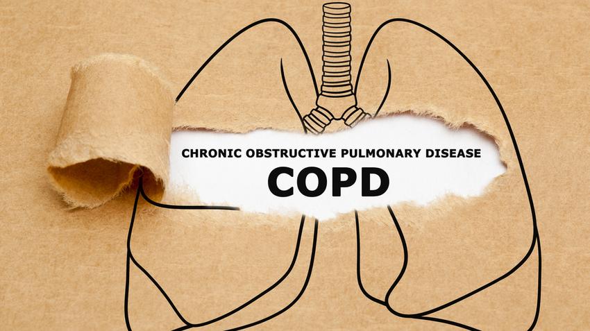 copd, diéta, tüdőbetegség, túlsúly