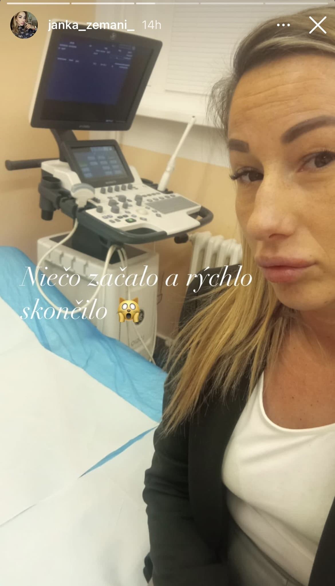 Exfarmárka Jana po krátkom tehotenstve potratila.