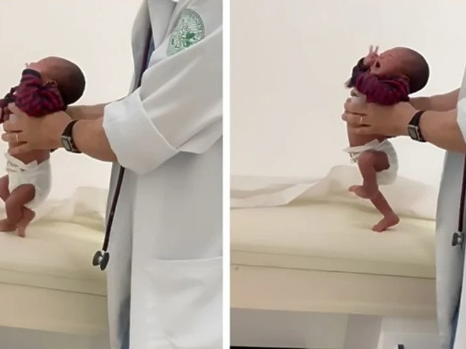 Beba pravi prve korake, ali nije srećna što mora da hoda