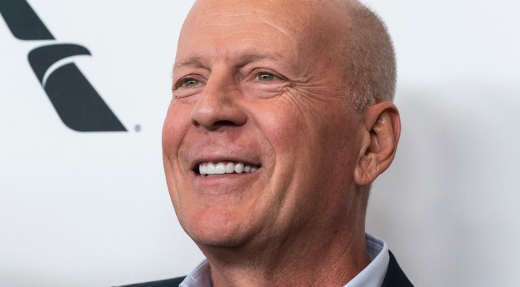 Néhány éve még ilyen kerek volt az arca, ma már teljesen máshogy néz ki Bruce Willis Fotó: Getty Images