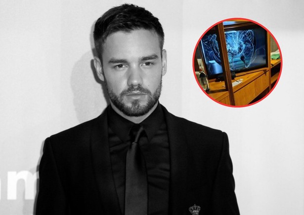 Liam Payne nie żyje. Szokujące zdjęcia jego pokoju trafiły do sieci