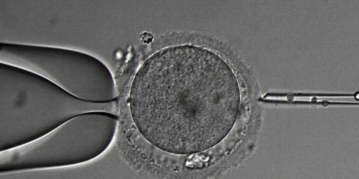 Zapłodnienie in vitro.