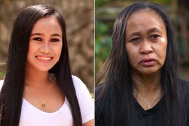 "Levo sam ja 2019. godine, desno sam ISTO JA 2020. godine: Preko noći sam OSTARILA, a sada ZNAM I ZAŠTO - sve je počelo od OVOG bezazlenog simptoma"