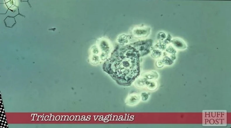 Parazit koji izaziva najviše sekusalno prenosivih bolesti u Americi   Protozoa koja izazvia najviše infekcija širom sveta   Protozoa koja izaziva dijareju   Parazit koji se prenosi iz kutija s peskom za mačke   I ove protozoe mogu da dovedu do smrtnog ishoda