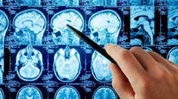 Jak witamina D wpływa na mózg? Chodzi o sprawność umysłową i ryzyko demencji