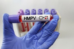 Wirus HMPV coraz bliżej Polski. Jakie są pierwsze objawy i kogo atakuje?