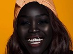 People with darker complexions have these advantages over those with lighter skin