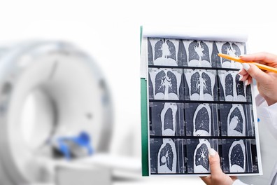 Nőnap alkalmából tüdőrákszűrő napot hirdet az Országos Korányi Pulmonológiai Intézet
