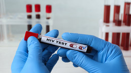 Wirus HIV wciąż groźny. Oto kto najczęściej choruje