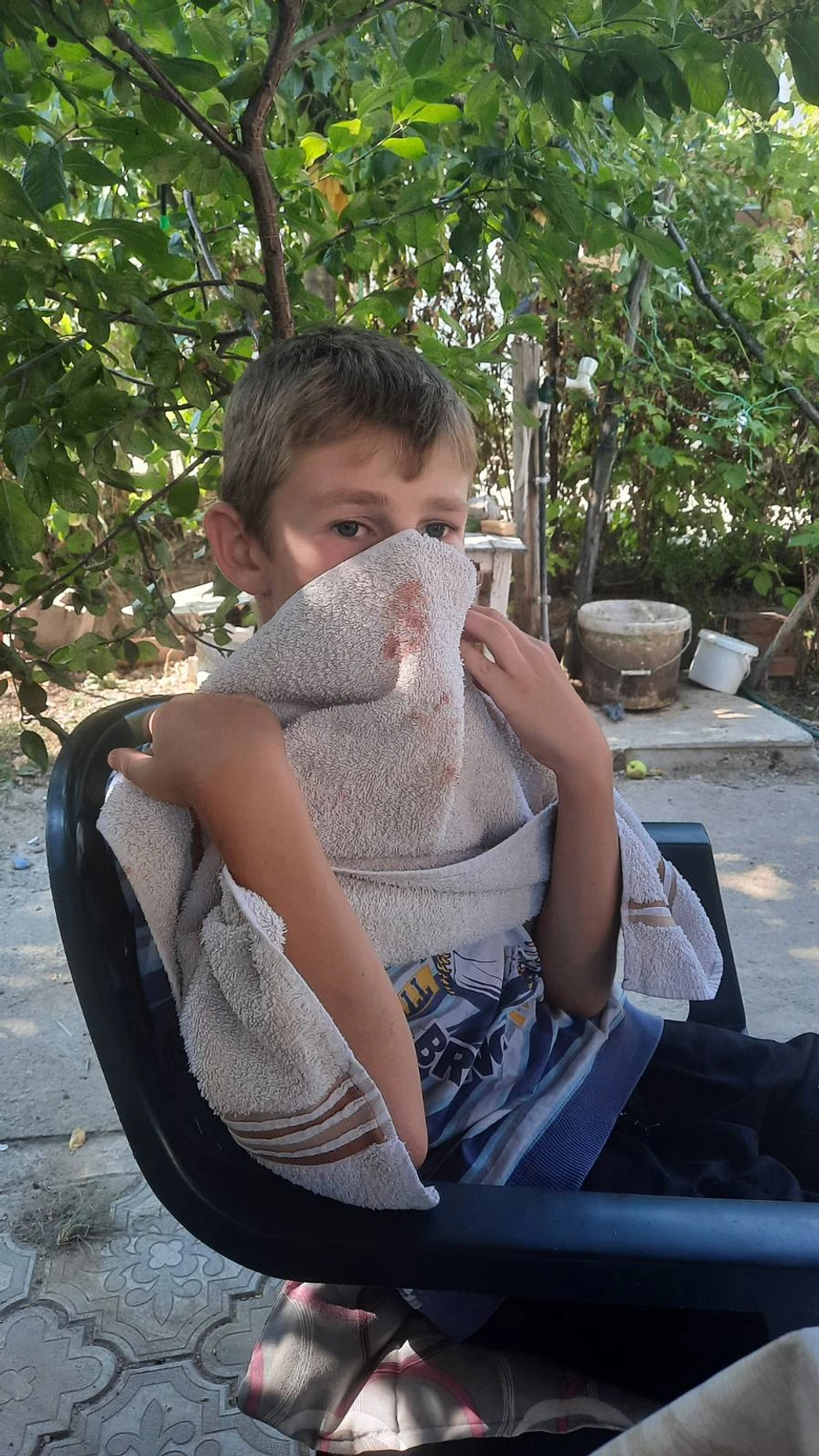 sremska mitrovica pretucen decak ustupljena fotografija