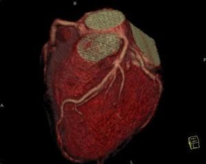 cardio003-d00000165968567351125
