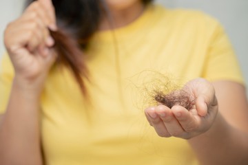 Nagyon hullik a hajam, hova menjek kivizsgálásra? Az orvos válaszol