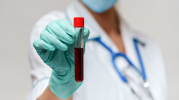 Lyme disease test - symptoms, of course, price