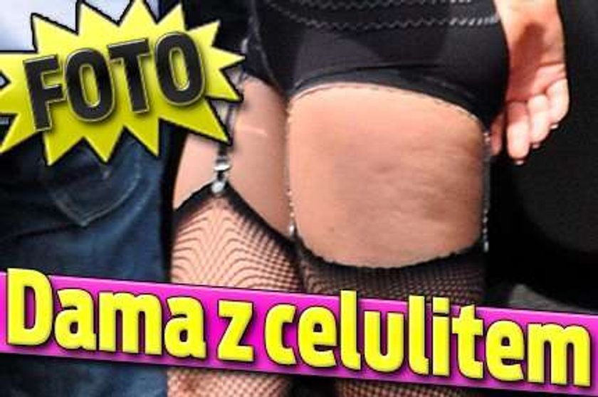 Dama z celulitem. Foto