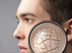 Skąd się biorą zmiany na skórze?