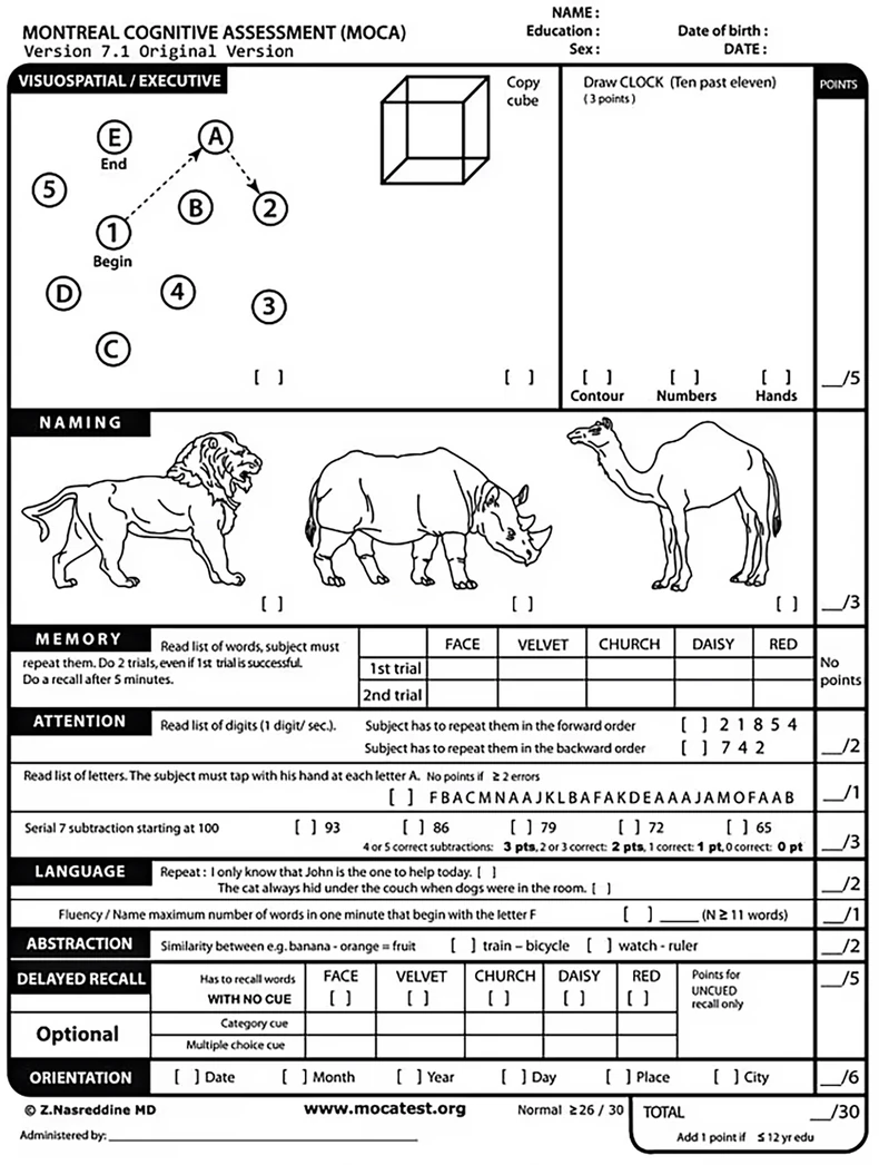 MoCA test mentalnih sposobnosti