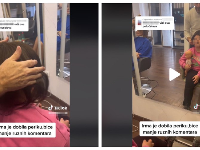 Devojčicu sa Daunovim sindromom ismevali zbog nedostatka kose, mama joj kupila periku  foto: screenshot/TikTok