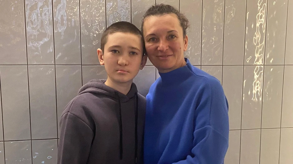 Nazar je rođen sa zečjom usnom i rasecenim nepcem tačno godinu dana pre nego što je izbio rat između Rusije i Ukrajine 2014. | Foto: BBC