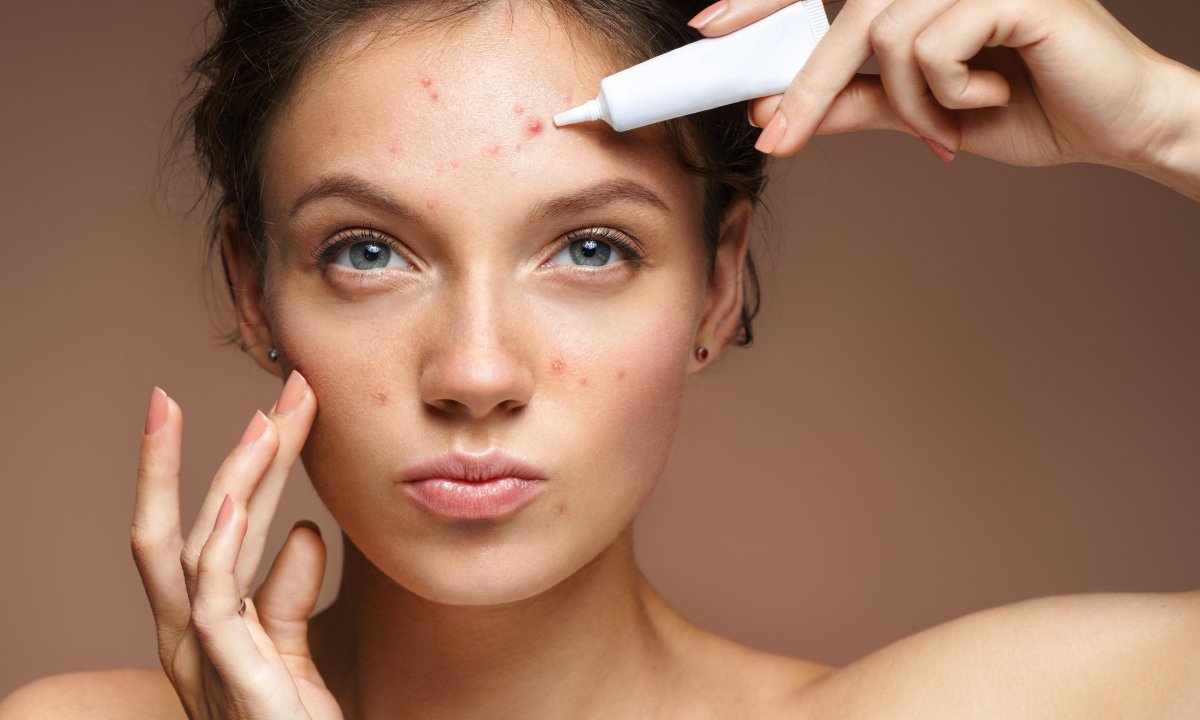 Skoncentrowany jak wiązka lasera, usunie pryszcza w jedną noc! SOS na niedoskonałości