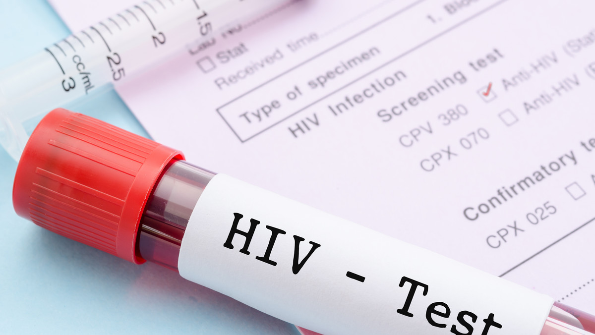 HIV: rośnie liczba zakażeń, maleje liczba ryzykownych kontaktów seksualnych