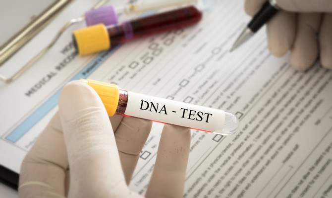 DNK test je otkrio šokantnu istinu