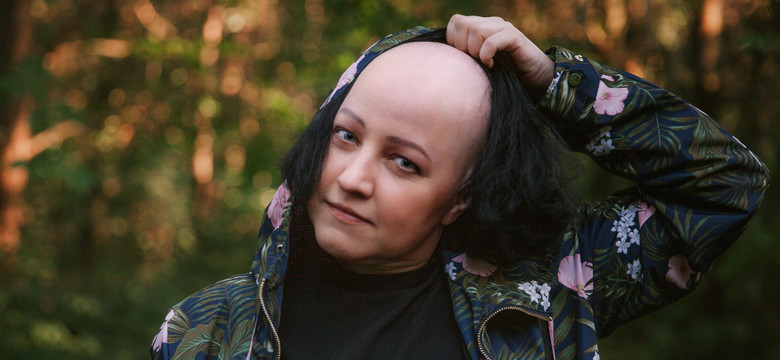 Autorka książki "Alopecjanki": Łysa kobieta powoli przestaje być już "babą z brodą"