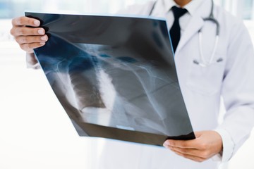 tüdőrák tüdődaganat diagnosztizálása tünete