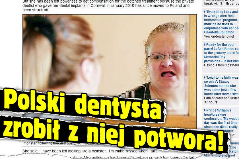 Polski dentysta zrobił z niej potwora