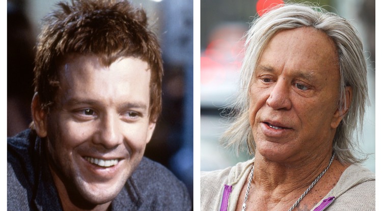 Mickey Rourke plasztika előtt és után