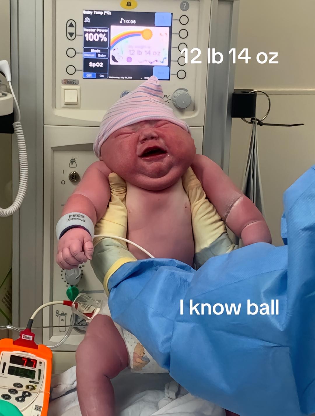 Shelby Martin priviedla na svet rekordného novorodenca.