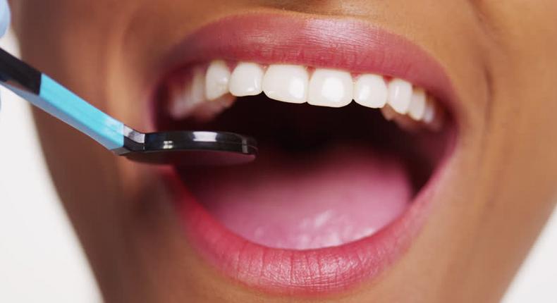 Simple home remedies that can help whiten your teeth