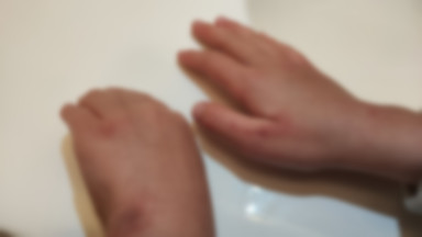 Oburzona posłanka PiS pokazała ręce córki. Tak wyglądają po tygodniu dezynfekcji