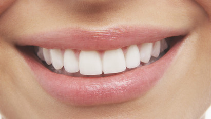 A ragyogó mosolyért: 3 egyszerű módszer a házi fogfehérítéshez