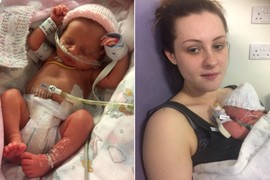 "Lekari su mi 14 PUTA rekli da treba da ABORTIRAM: Odbila sam, izdržala trudnoći i OVO je moja ćerka"