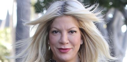 Wszystkie oblicza Tori Spelling. Co się stało z jej twarzą?