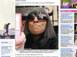 Pokazała trądzik, a media jej to wytknęły