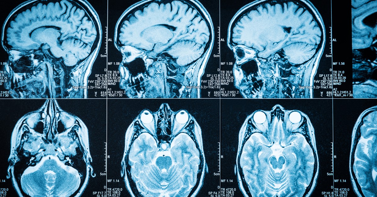 Los científicos están cada vez más cerca de comprender por qué fracasan los mejores tratamientos contra el cáncer