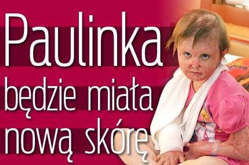 Paulinka będzie miała nową skórę