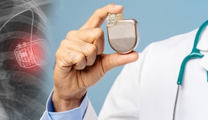 Implantabilni kardioverter-defibrilator (ICD) je mali uređaj koji stalno nadgleda srčani ritam i automatski daje elektrošokove u slučaju opasnih aritmija