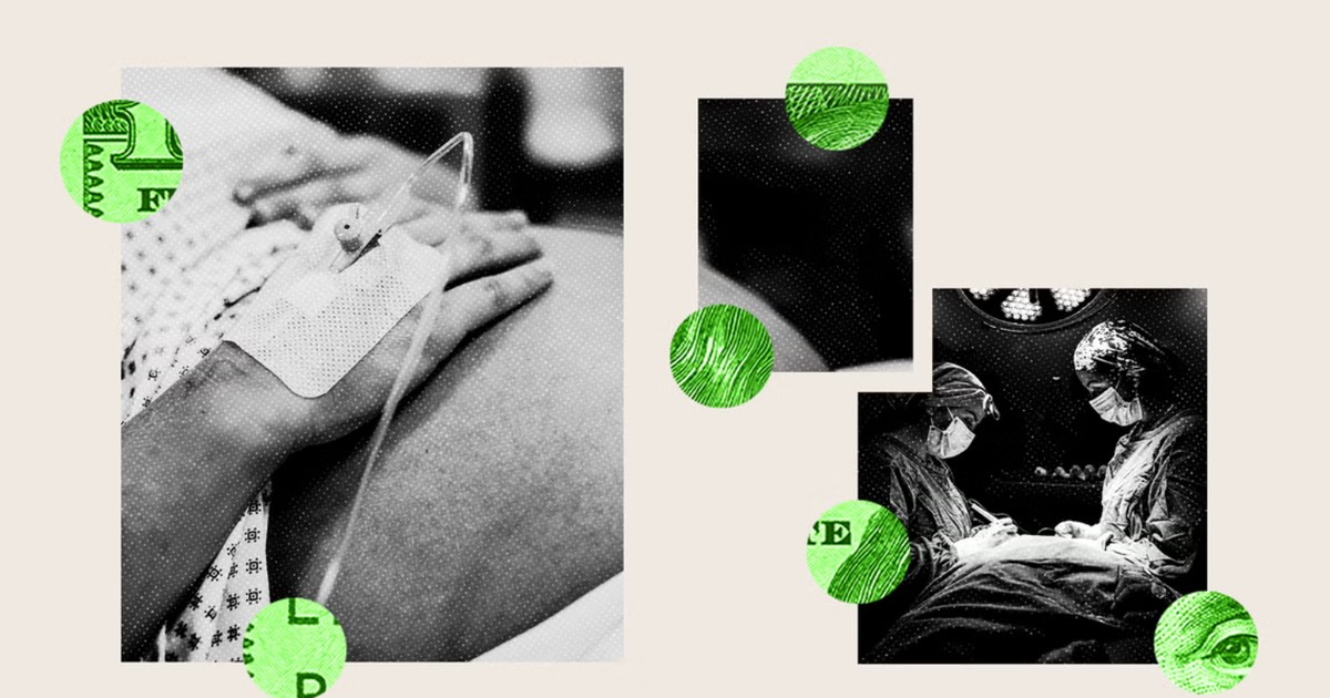 Biznes cesarskich cięć w USA. Setki tysięcy kobiet każdego roku przechodzą operacje, których nie potrzebują