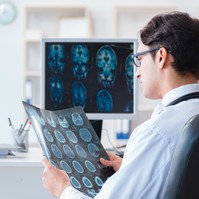 PTE: új diagnosztikai és műtéti eljárások az epilepszia kezelésében